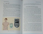 Štechová Kateřina - Technologie v diabetologii