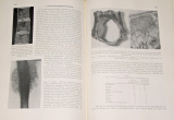 Schinz, Baensch, Friedl - Lehrbuch der Röntgendiagnostik (Band 1-Skelett)