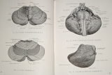 Kiss, Szentágothai - Anatomischer Atlas des menschlichen Körpers, Band I.-III.