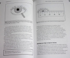 Stein, Freeman - Contact Lenses: Fundamentals and Clinical Use